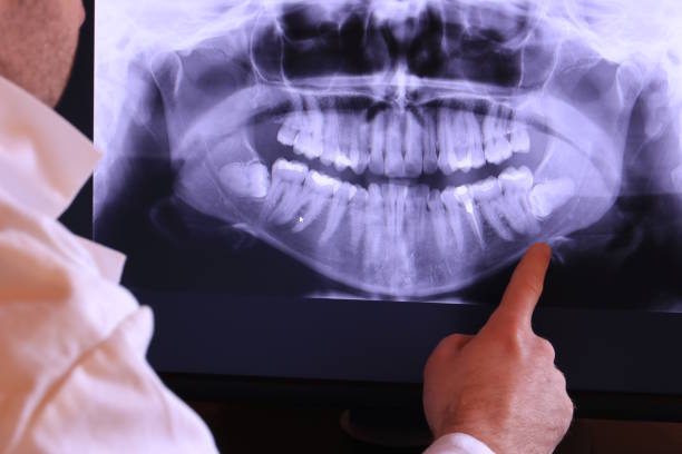 Urgent Tooth Repair in AL